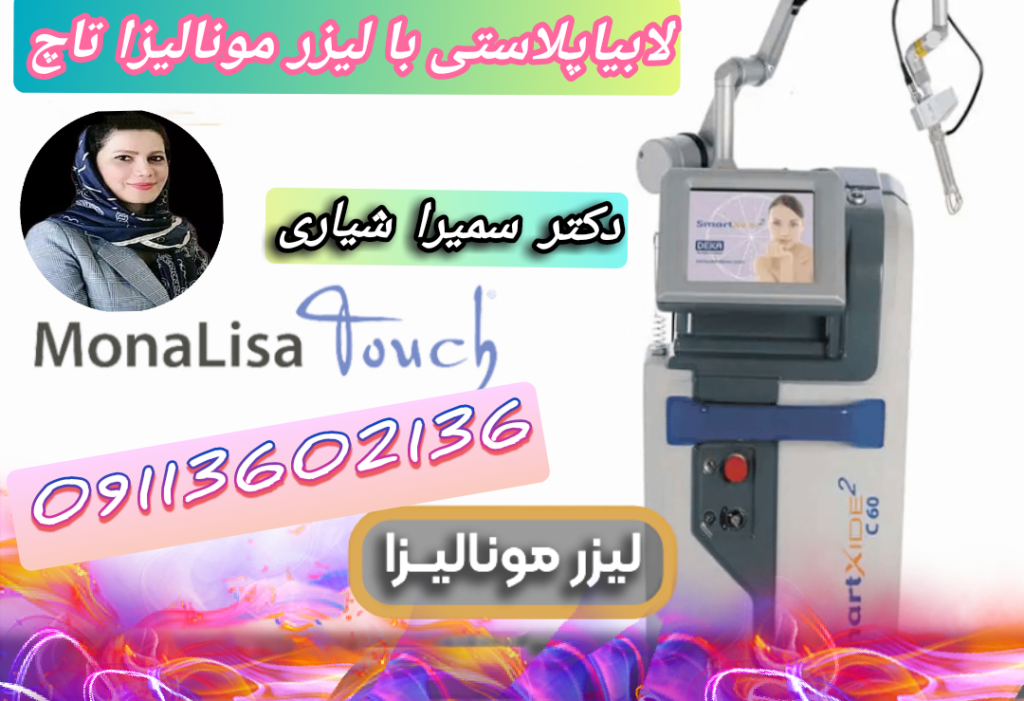 بهترین دکتر لابیاپلاستی با لیزر مونالیزا در رشت