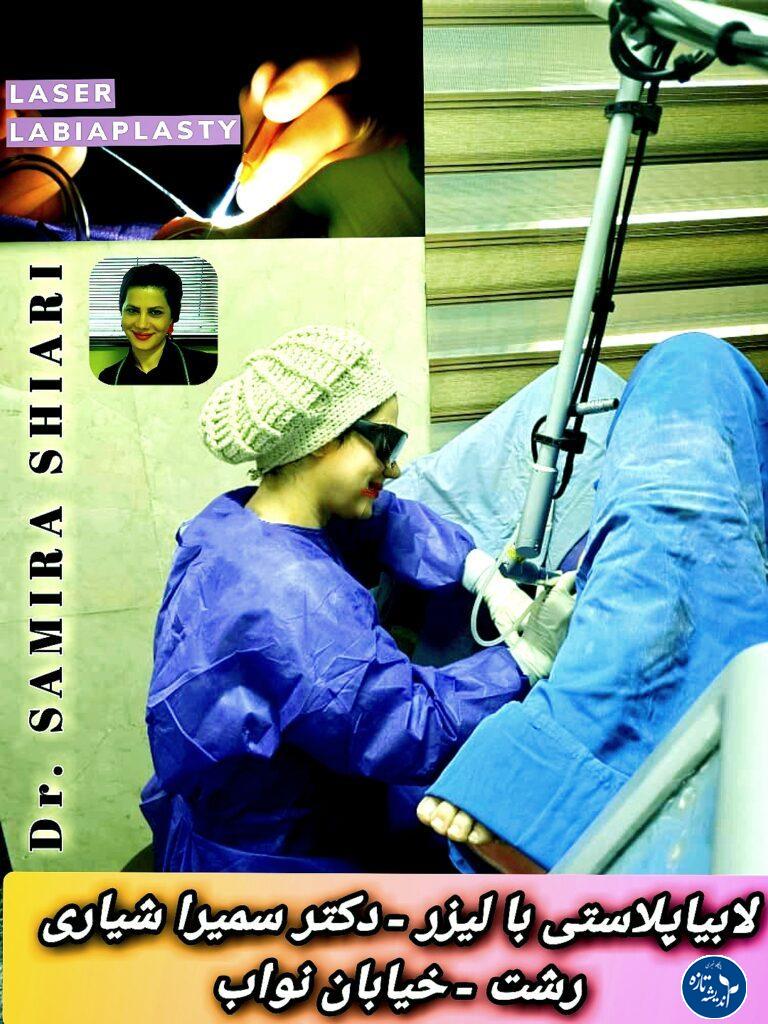 بهترین دکتر لابیاپلاستی با لیزر در رشت