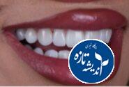 دندان پزشکی در دوران بارداری، دکتر شیاری